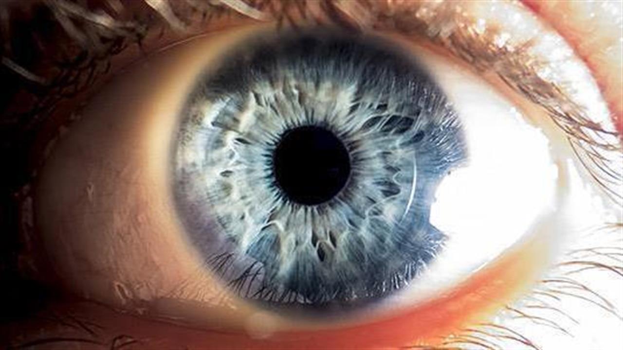 Διασφάλιση υγείας ασθενών με παθήσεις της ωχράς κηλίδας που απειλούν την όραση